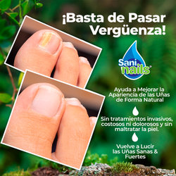 SaniNails Solución de Copaiba – Cuidado Natural para Uñas y Mejor Apariencia