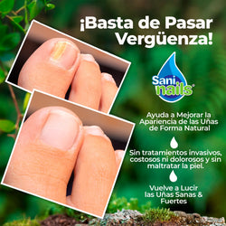 1771424937SANINAILS_ML_05 - Needify
