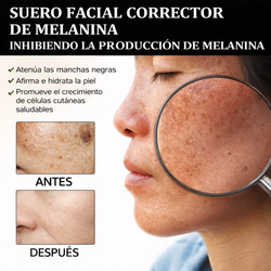 Serum Facial Vitamina C y Arbutina – Iluminación y Tono Uniforme