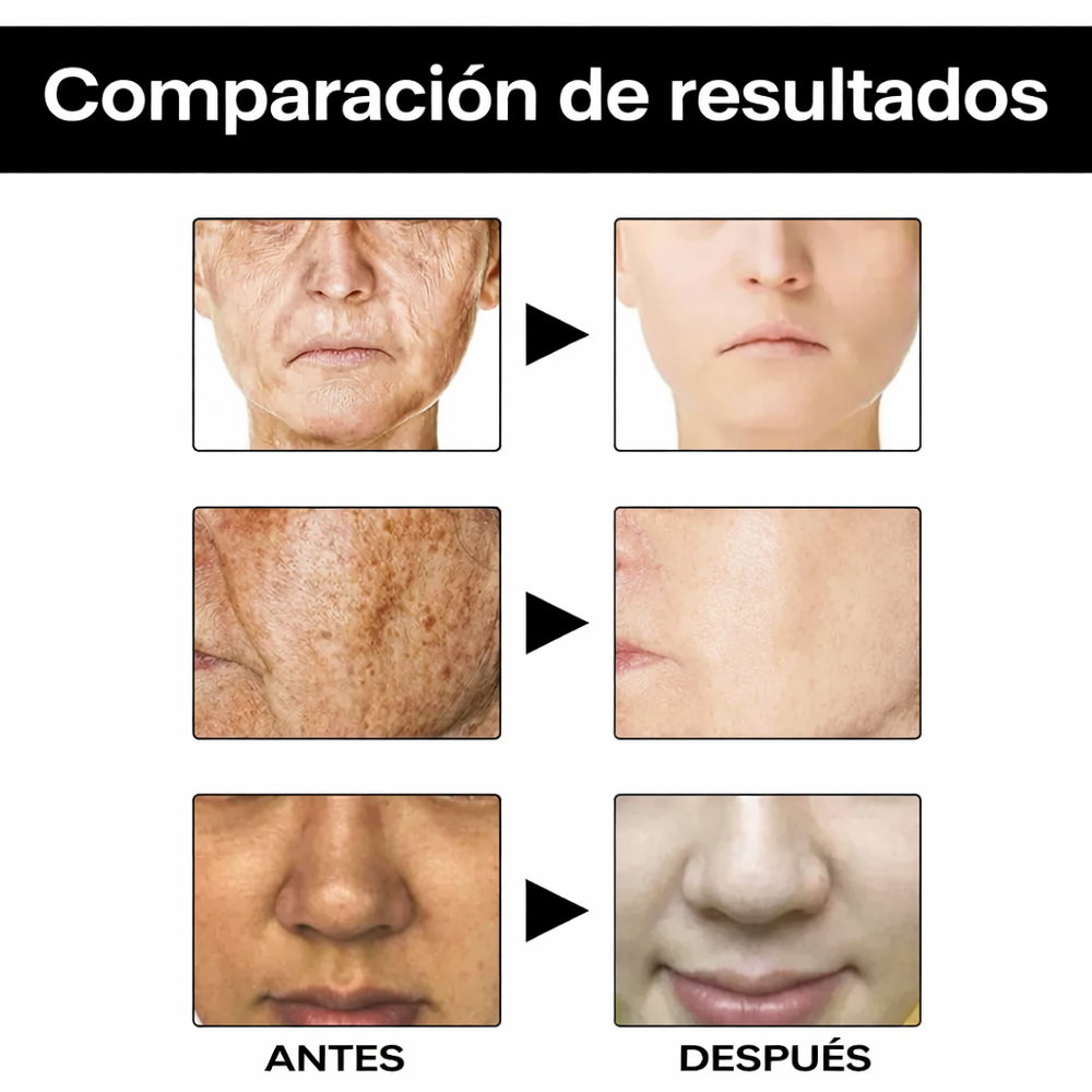 Serum Facial Vitamina C y Arbutina – Iluminación y Tono Uniforme