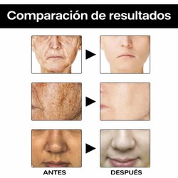 Serum Facial Vitamina C y Arbutina – Iluminación y Tono Uniforme