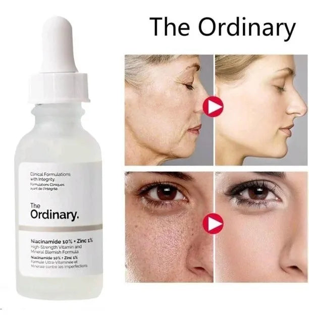 The Ordinary Niacinamide 10% + Zinc 1% – Sérum Facial Equilibrante y Control de Grasa