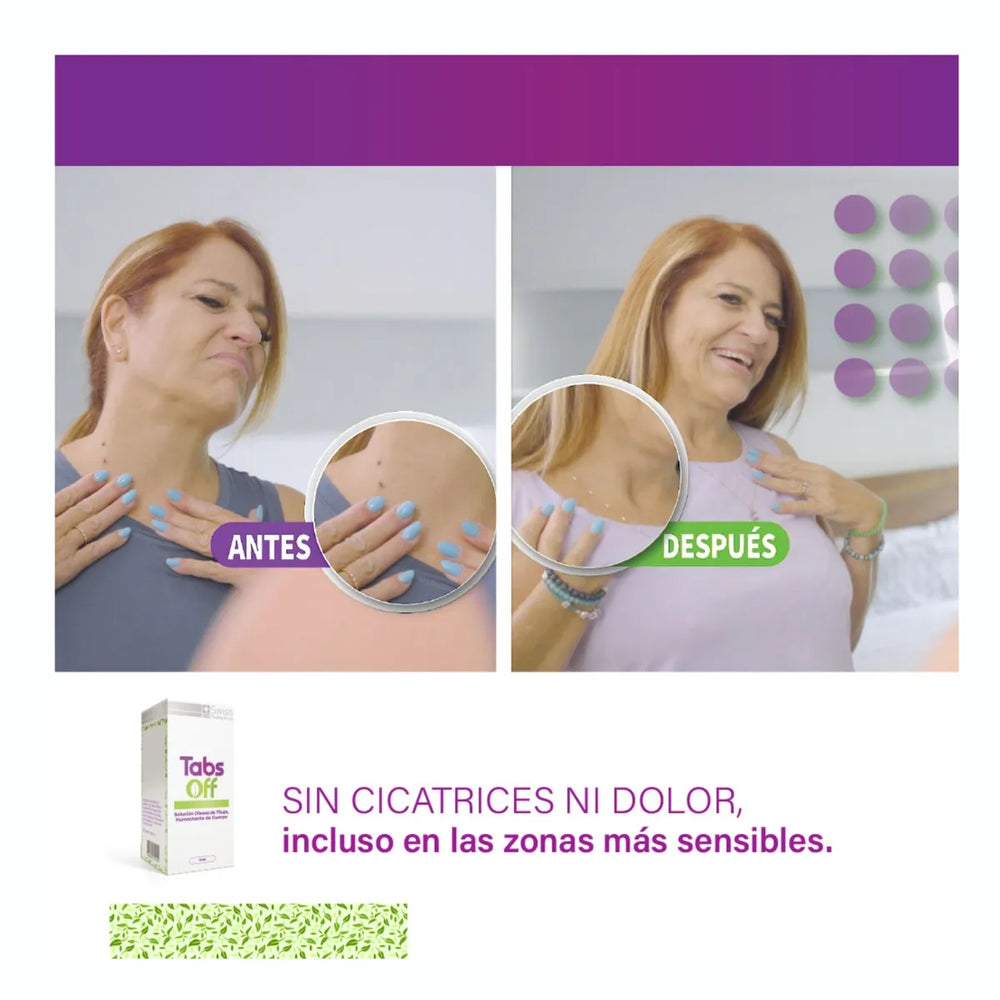 Tabs Off Thuja 15 ml – Cuidado de Imperfecciones y Bienestar de la Piel